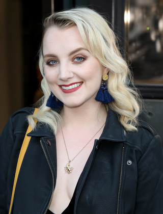 Singlimni korib qoldi