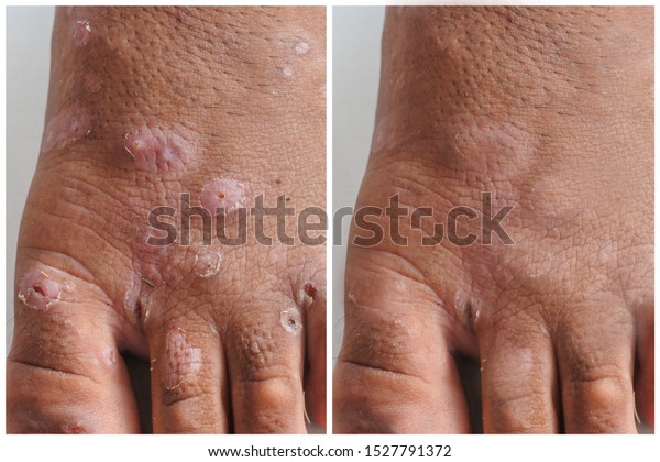 Dermatologist Raleigh Nc