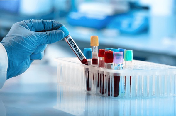 doctor hand taking a blood sample tube from a rack with machines of analysis in the lab background / Technician holding blood tube test in the research laboratory Stock Photo