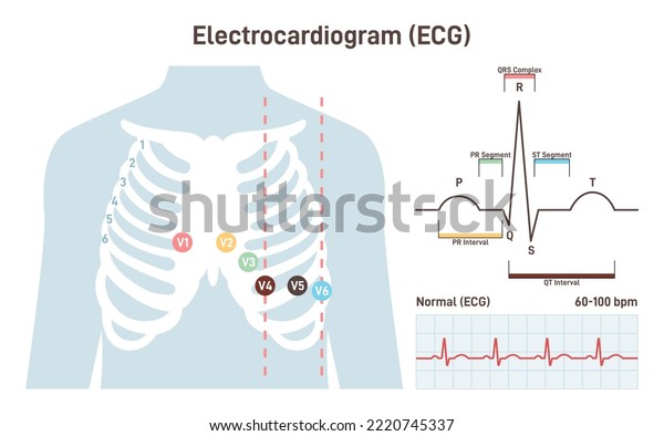 Ecg Procedure Cardiovascular Checkup Cardiogram Heart Stock Vector ...