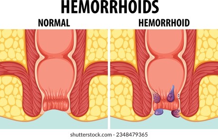Krivoy Rogda jinsiy aloqa uchun qiz qidirilmoqda