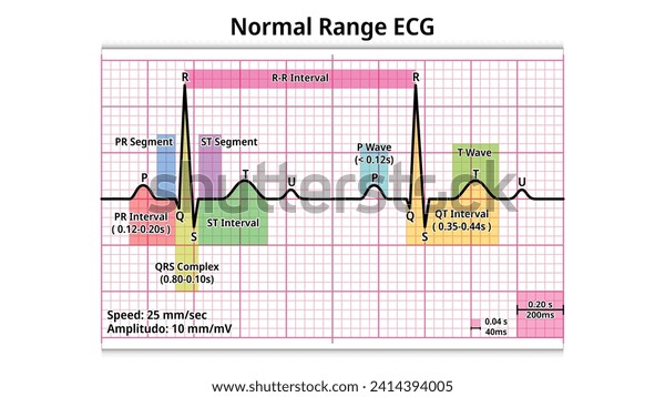 Normal Range Ecg Pr Interval Qrs Stock Vector (Royalty Free) 2414394005 ...
