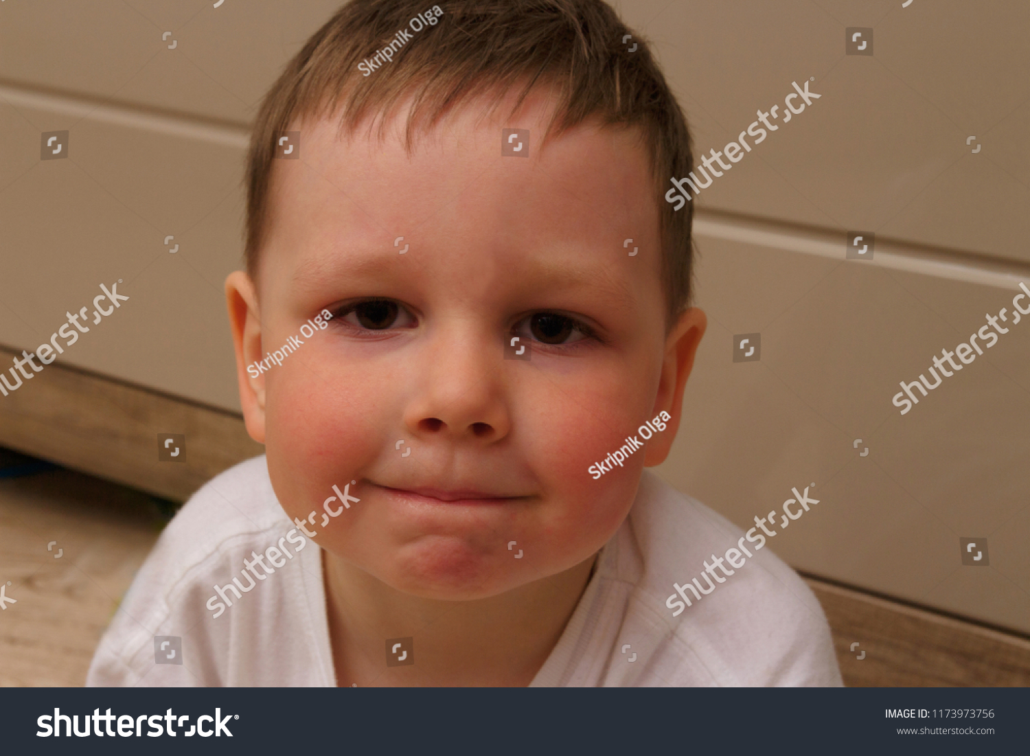Portrait Child Boy Red Cheeks Temperature Stock Photo 1173973756