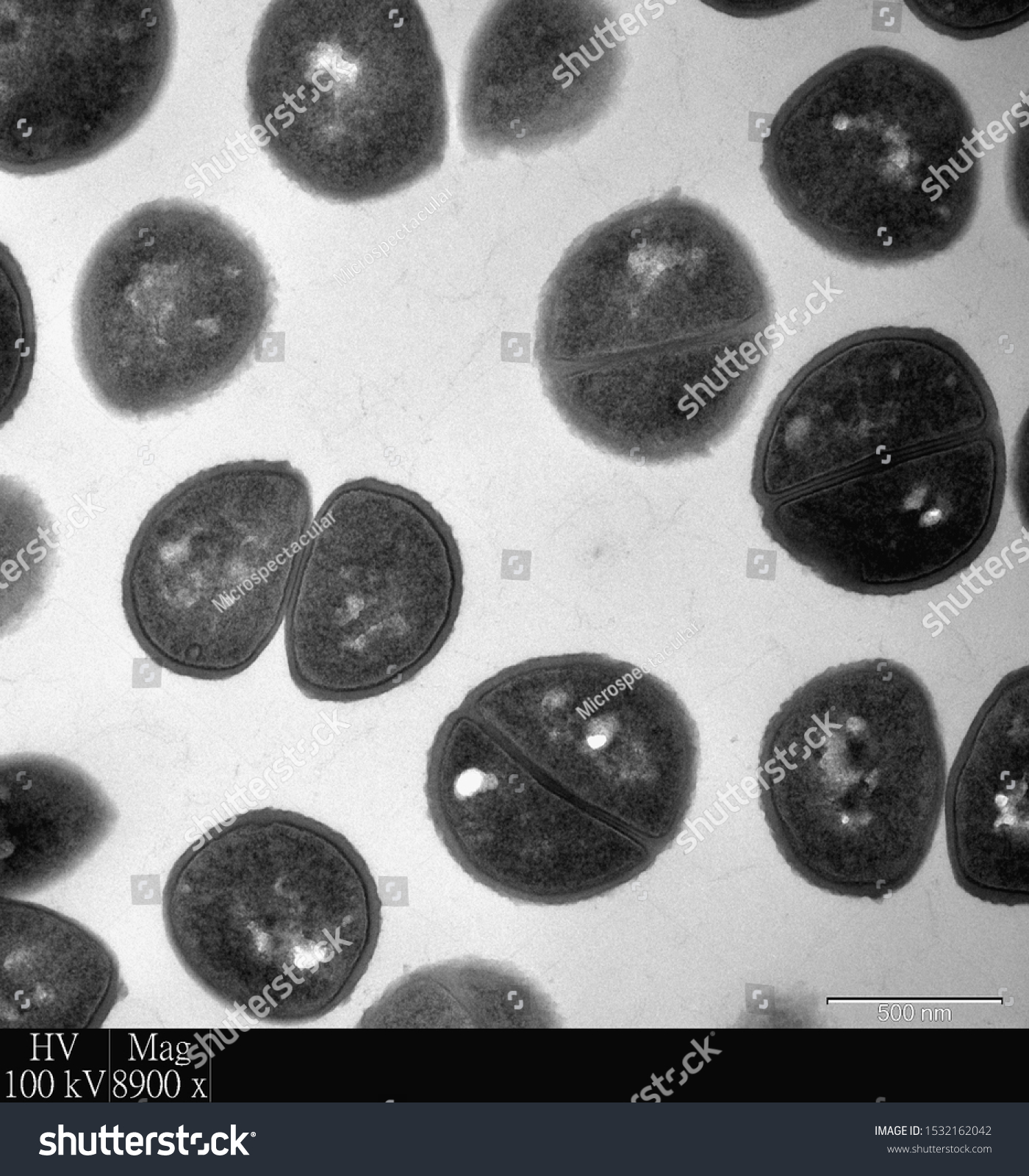 Transmission Electron Microscope Bacteria SexiezPicz  Porn