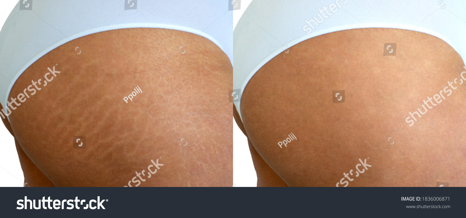 376 Images Stock Photos Vectors Shutterstock 376-images-stock-photos-vectors-shutterstock