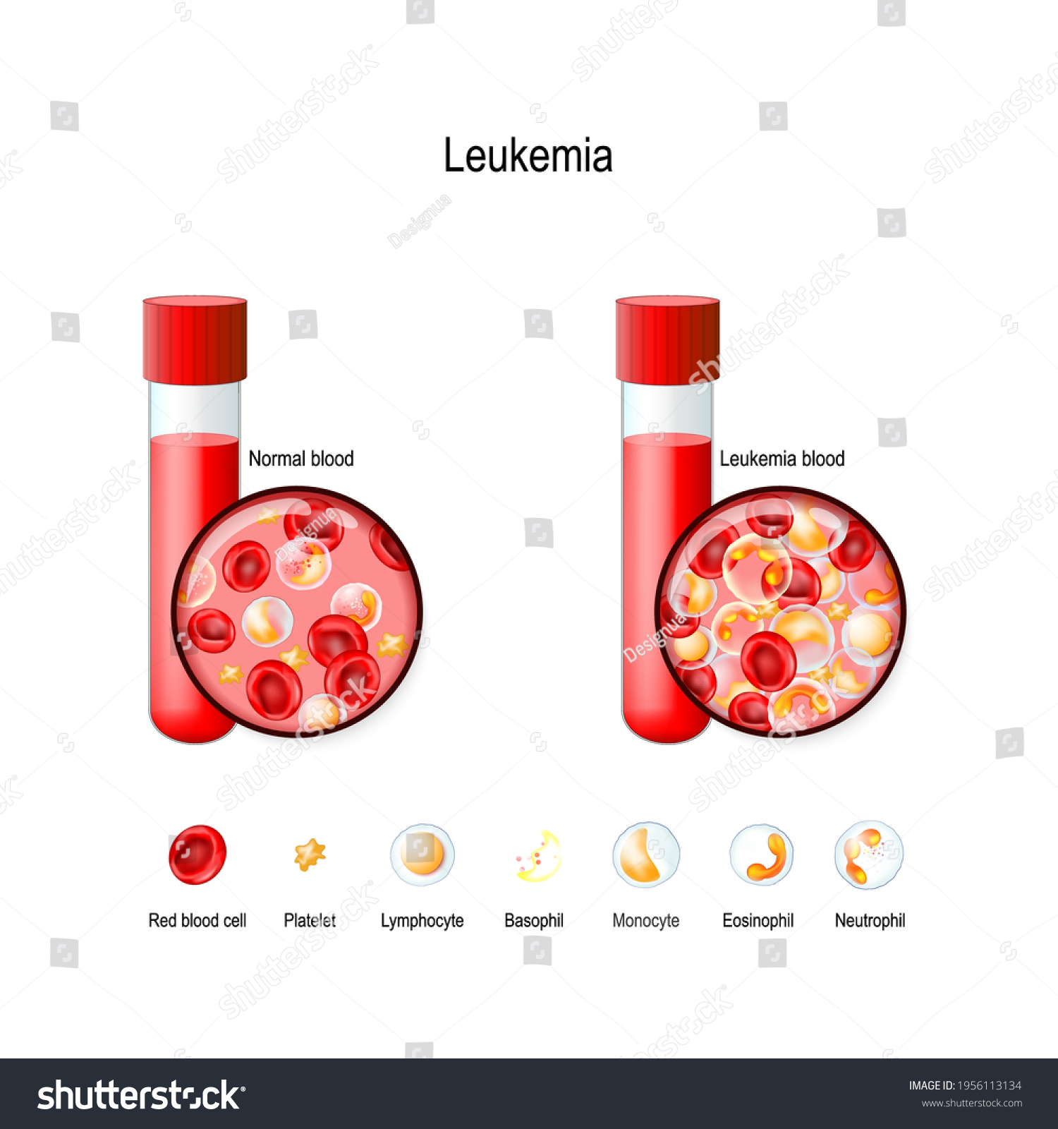 1,212 Basophils Test Images, Stock Photos & Vectors Shutterstock