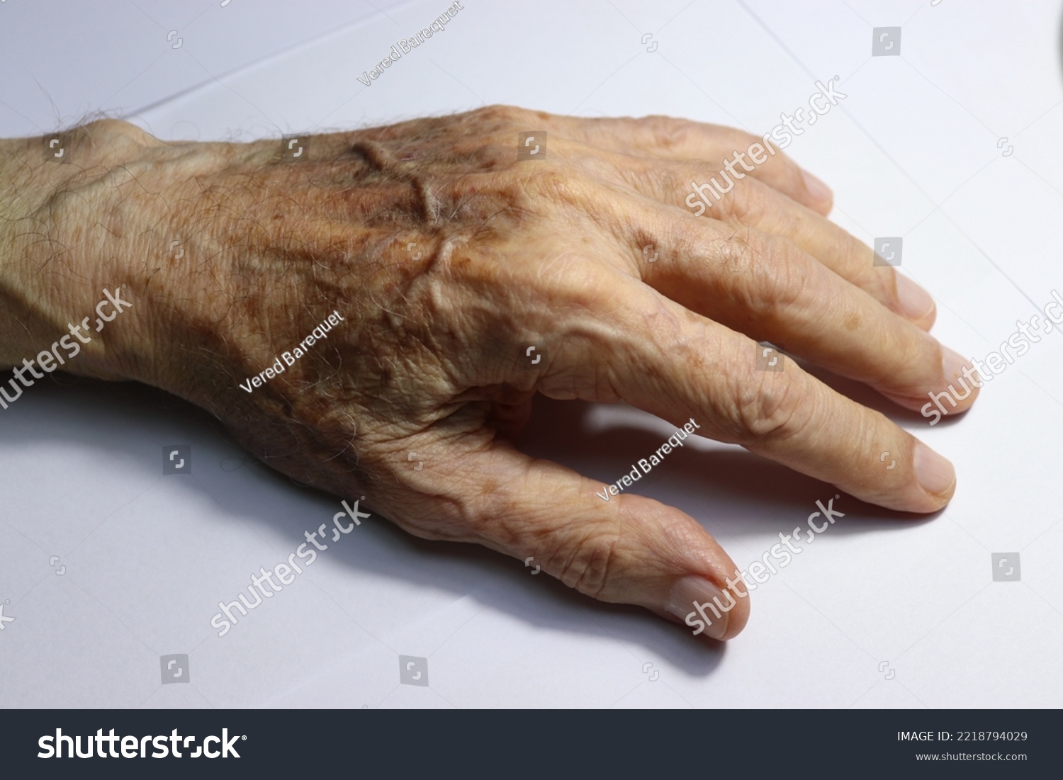 Hématome homme 1 861 images, photos et images vectorielles de stock Shutterstock