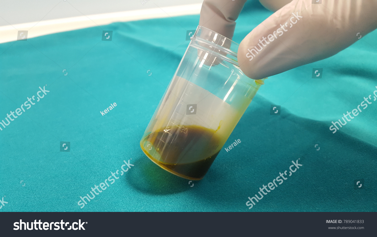 Bile Color